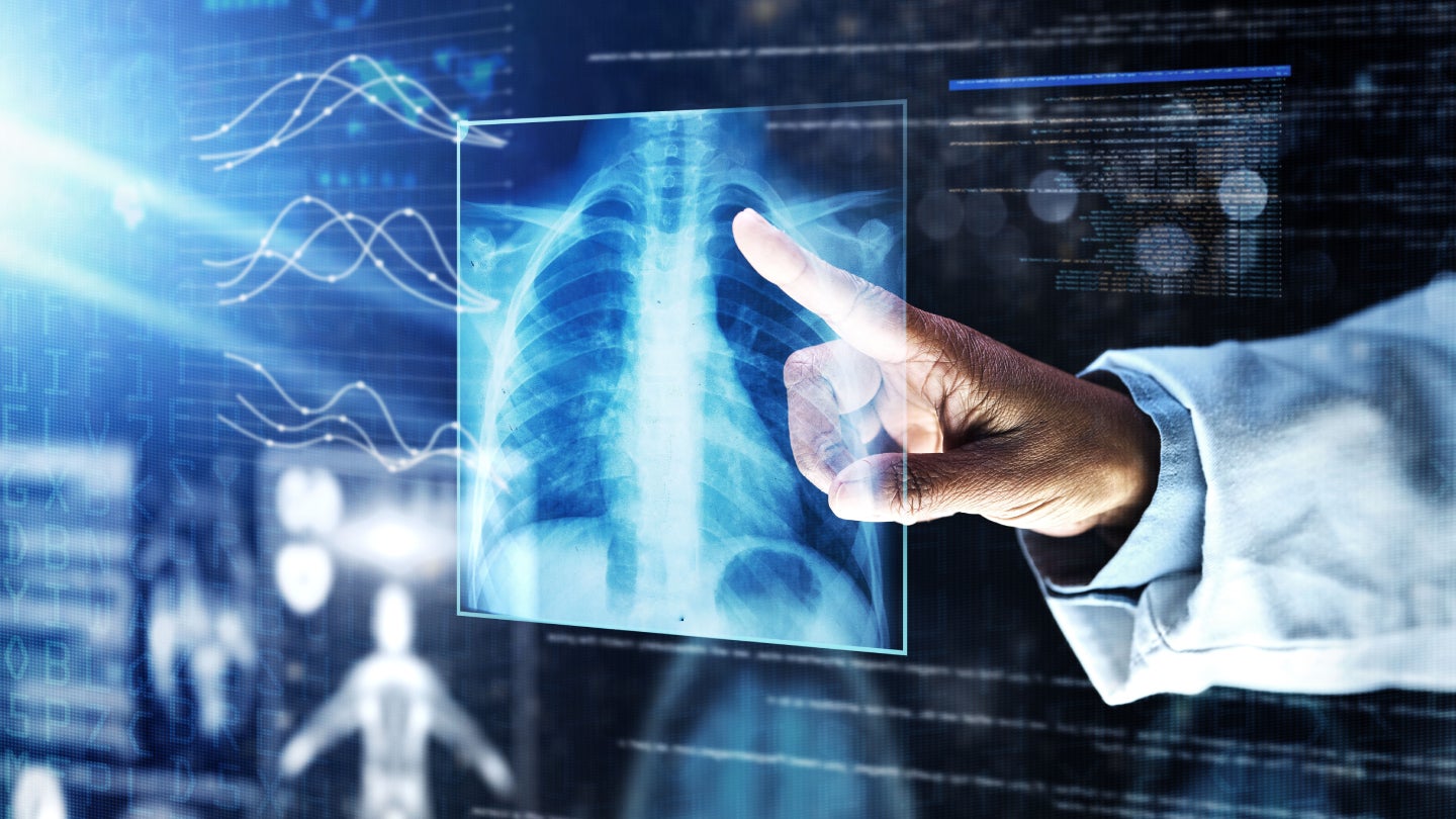 Artificial Intelligence Market Insights: Invenio Imaging Inc. On-Site Study for Lung Cancer Detection