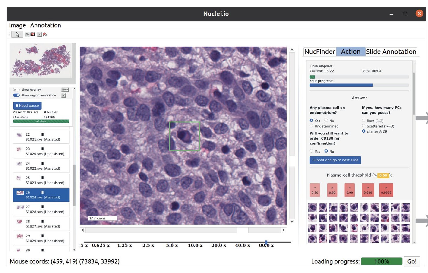 AI and Machine Learning in Clinical Pathology: Revolutionizing Diagnostic Accuracy