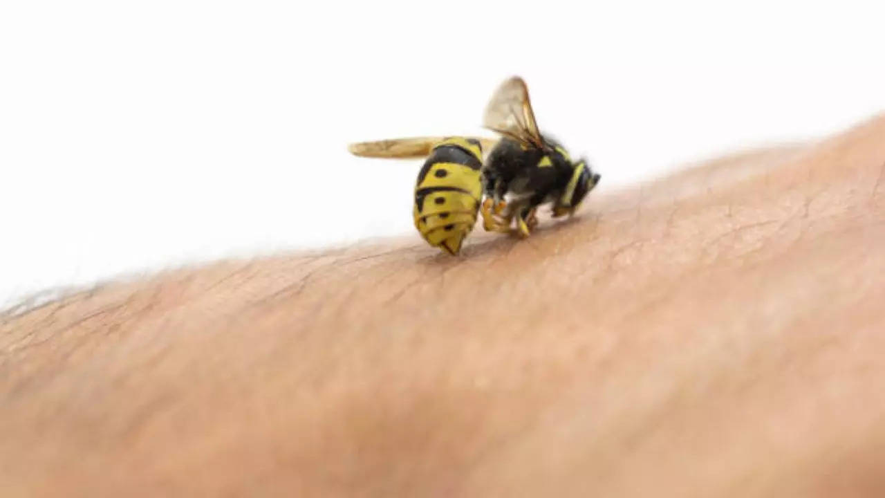 Ultimate Guide: How to Treat Bee Stings at Home