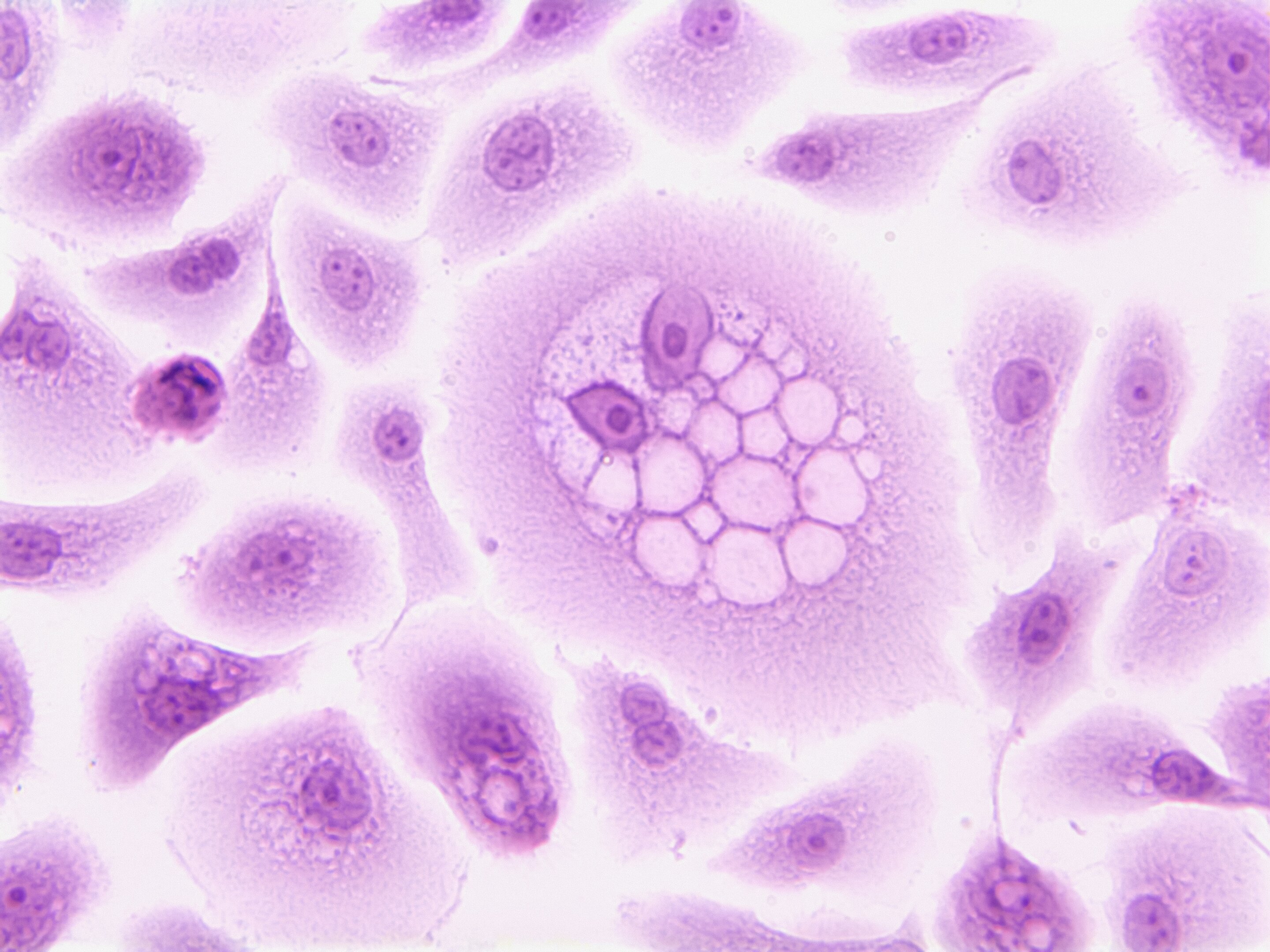 Cell Death Solution: Decoding the Proteasome's Role in Ferroptosis