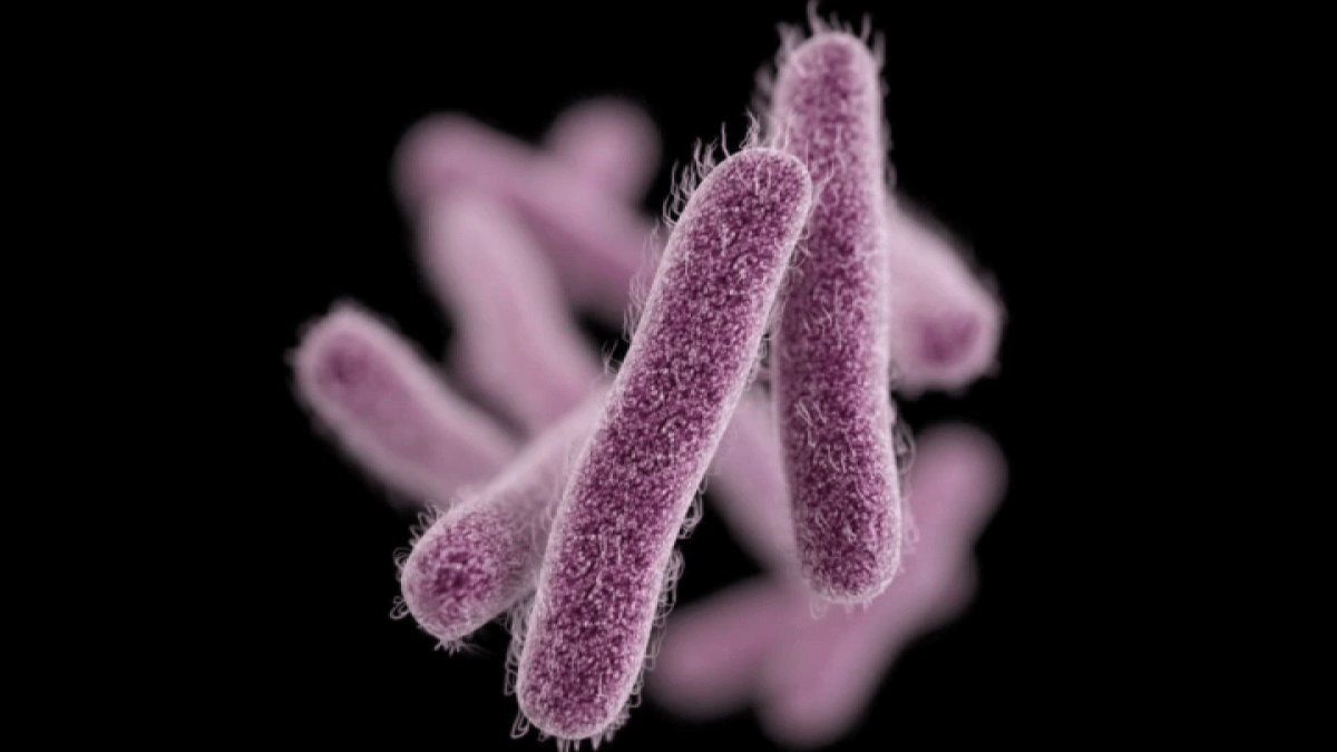 Shigella Outbreak in San Jose: Disease Spread in Santa Clara County