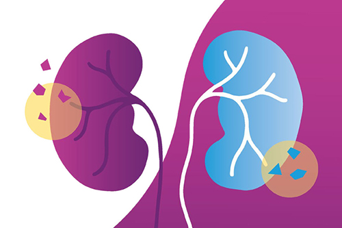 Addressing Health Inequalities for Kidney Health - Tips for a Healthier Future