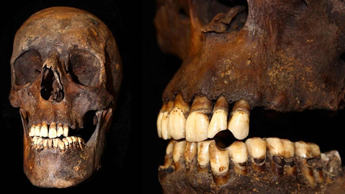 Tobacco Smoke Impact on Homo Skeletons: Uncovering the Truth