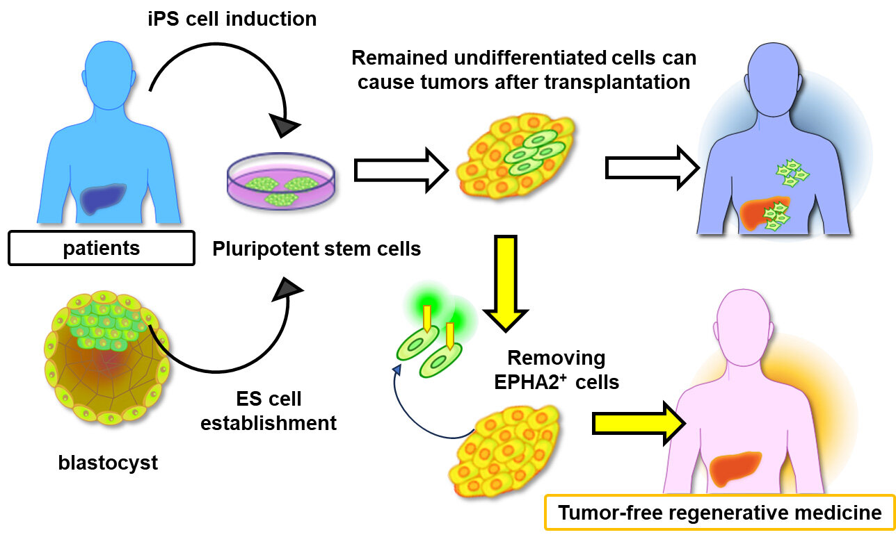 Understanding the Role of EPHA2 in Stem Cell Therapies to Prevent Tumor Formation