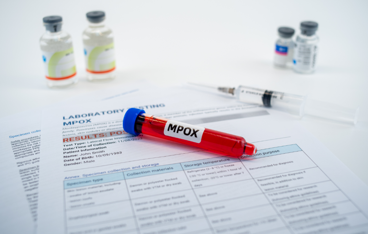 Monkeypox Virus Detection: Tips for Rapid Diagnostic Solutions