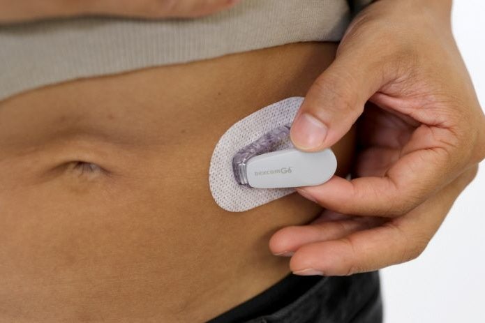 Dexcom's Market Strategy Amid Earnings Report Impact