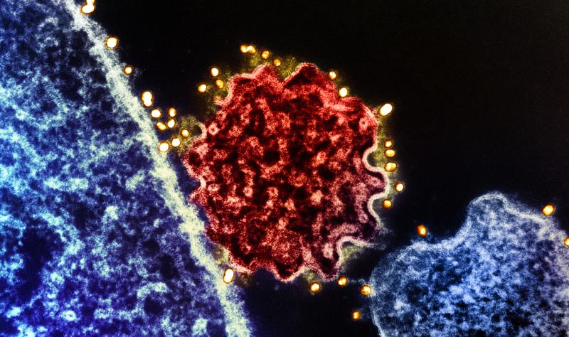 Discover the Monoclonal Antibody Solution for Nipah Virus