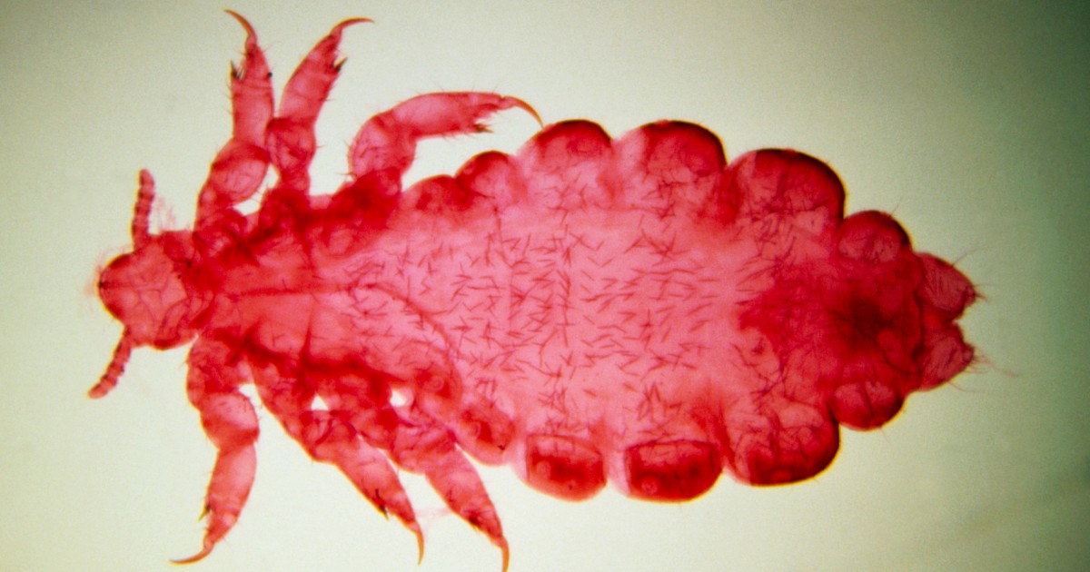 New Study Reveals Potential Role of Body Lice in Spreading Bubonic Plague