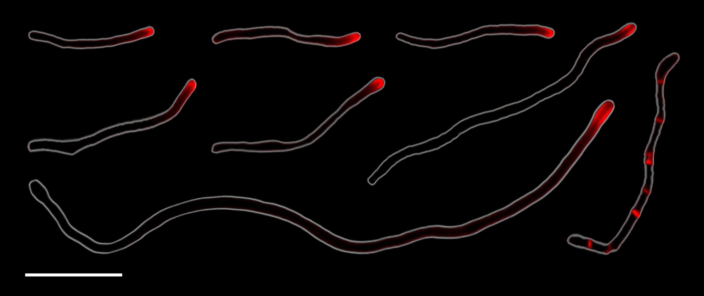 Bacteria Breakthrough: The Innovative Cell Division of Corynebacterium matruchotii