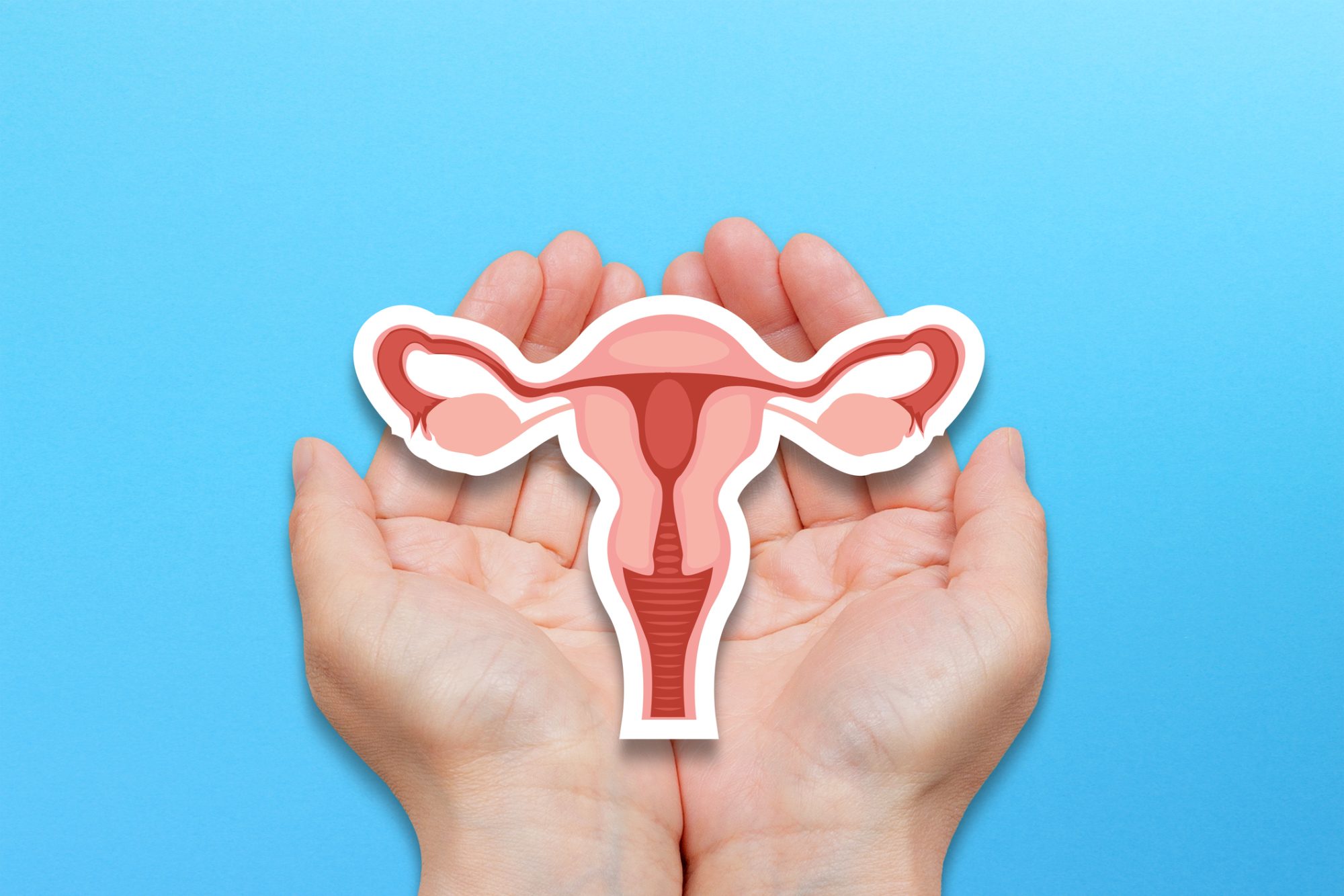 Understanding Polycystic Ovary Syndrome: Impact on Menstruation