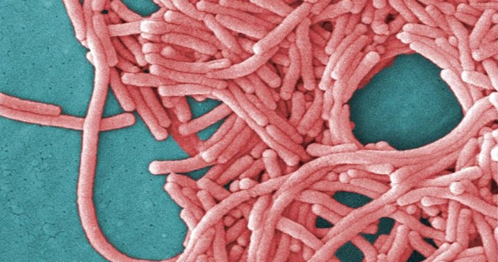 Legionnaires' Disease Outbreak in London: Tips for Prevention