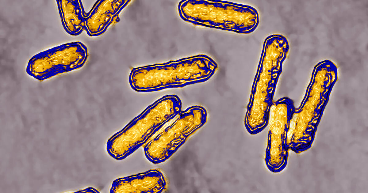 CDC Investigates Listeria Outbreak: Tips to Stay Safe