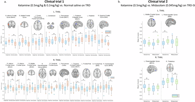 Unlock the Healing Power of Ketamine for Mental Wellness