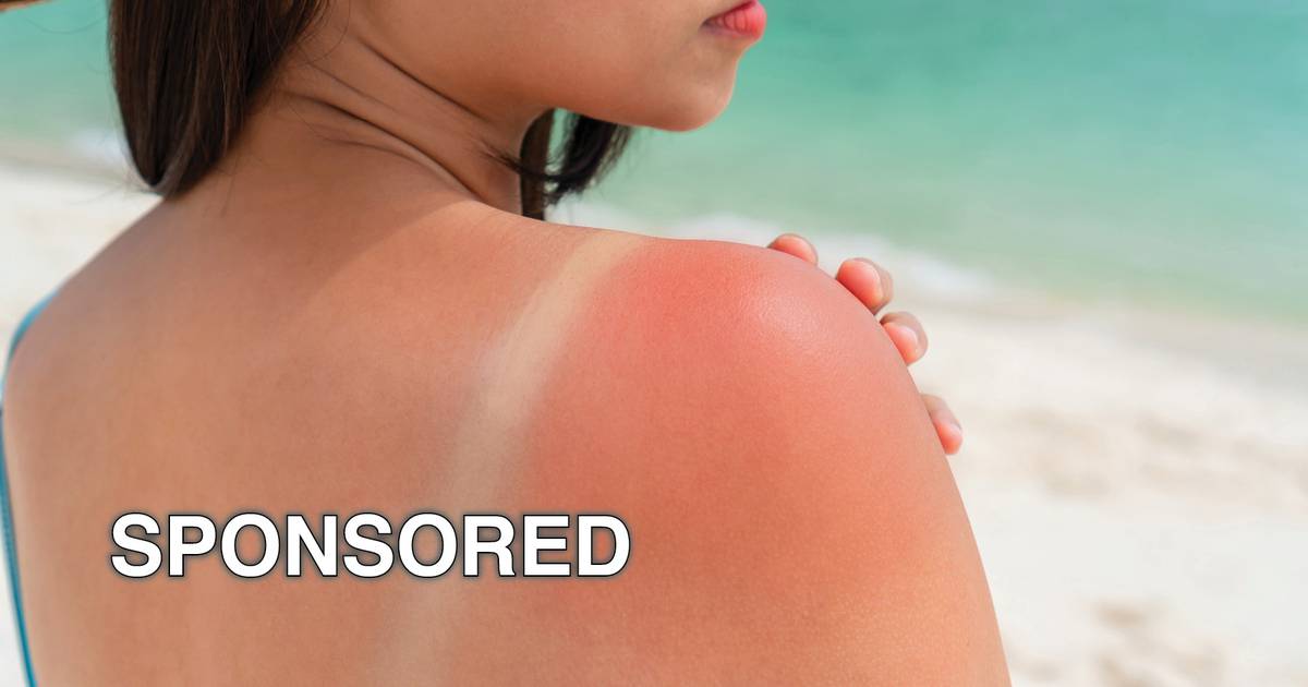 Easy Tips for Healthy Sunburn Solution