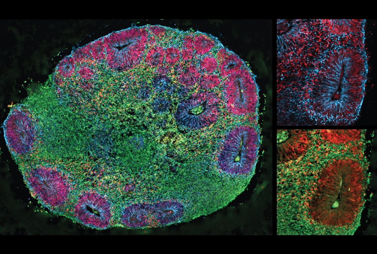 Unlocking the Wellness of Chimeroids for Personalized Neurodevelopment