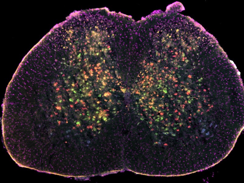 AI Research on Neuron Circuits Impacted by ALS