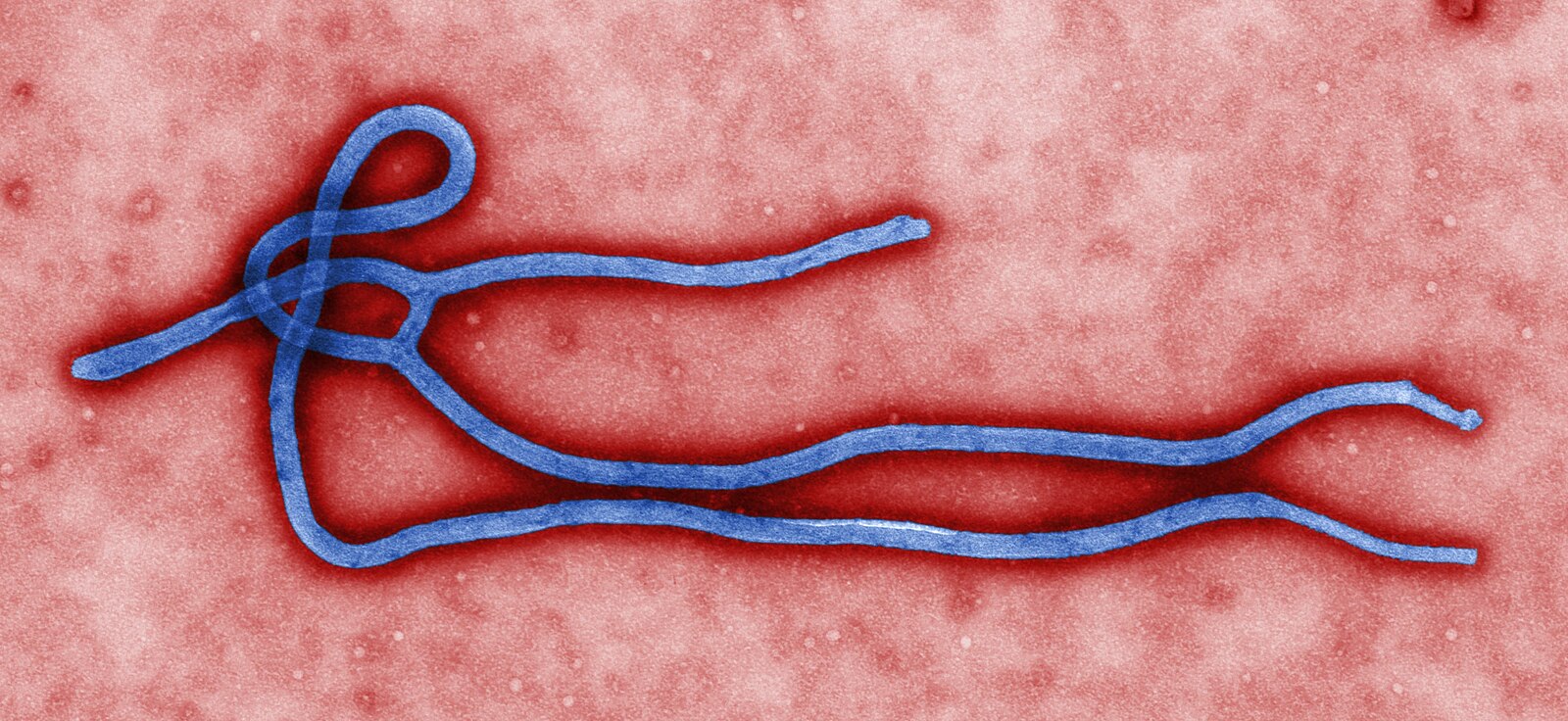 Ebola Treatment Tips: US Government Supports Development of Opaganib