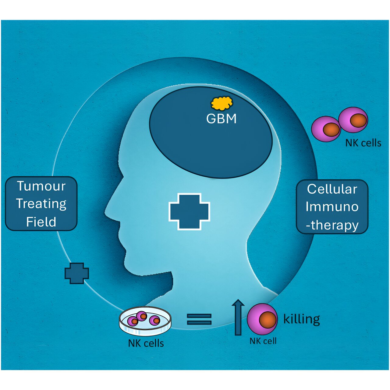 Natural Killer Cell Tips: Enhancing Brain Tumor Treatment with Electric Currents