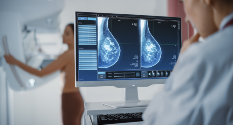 AI Tips for Healthy Breast Cancer Detection