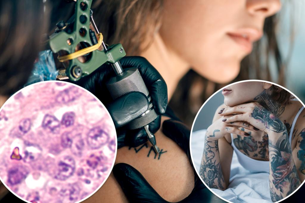 Study Reveals Potential Link Between Tattoos and Lymphoma Risk Factors