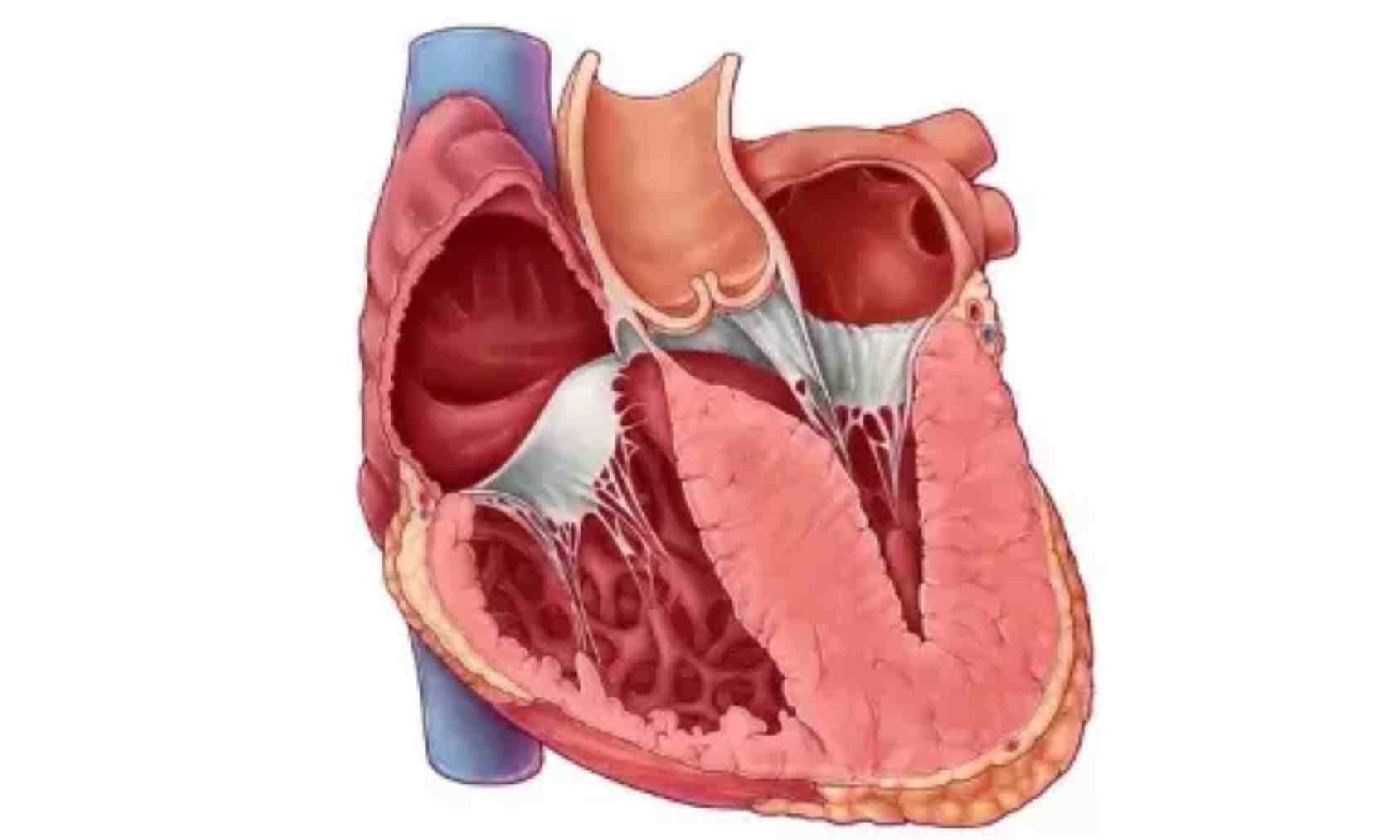 Gadolinium Solution: Tips for Predicting Sudden Cardiac Death in Young Patients with Hypertrophic Cardiomyopathy