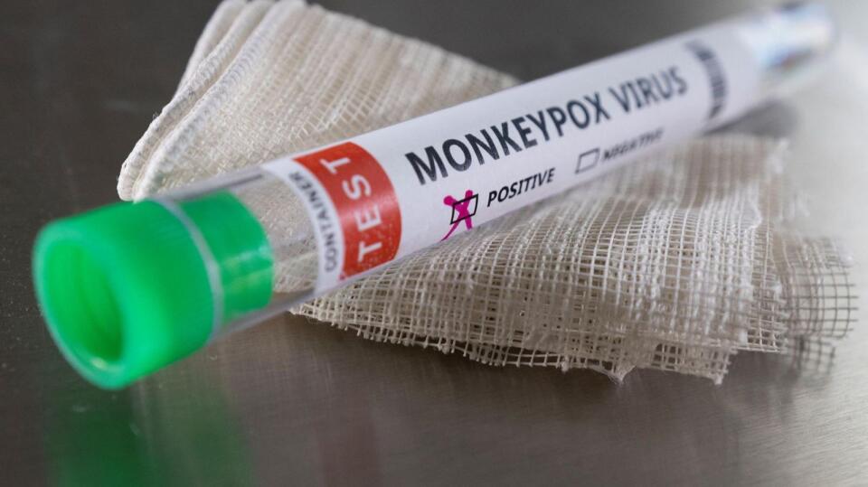 Tips for Monitoring Mpox Outbreak: South Africa Health Solution