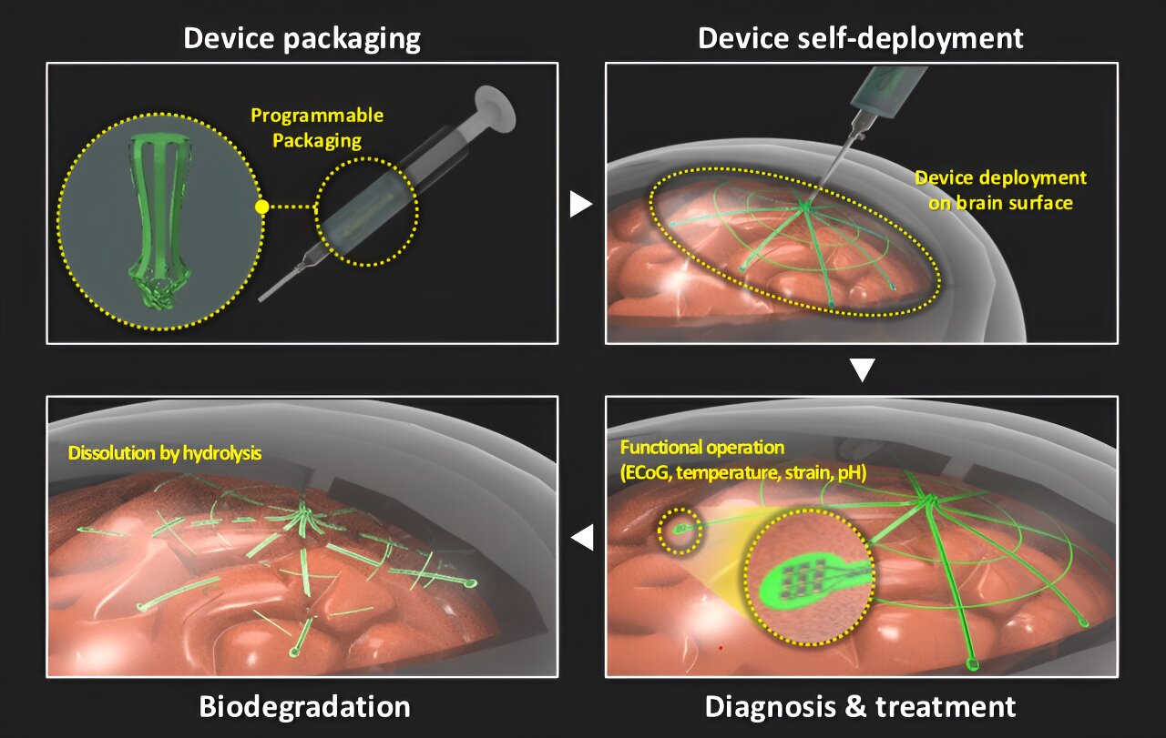 Brain Electrode Revolution: Biodegradable Technology for Healthy Monitoring Tips