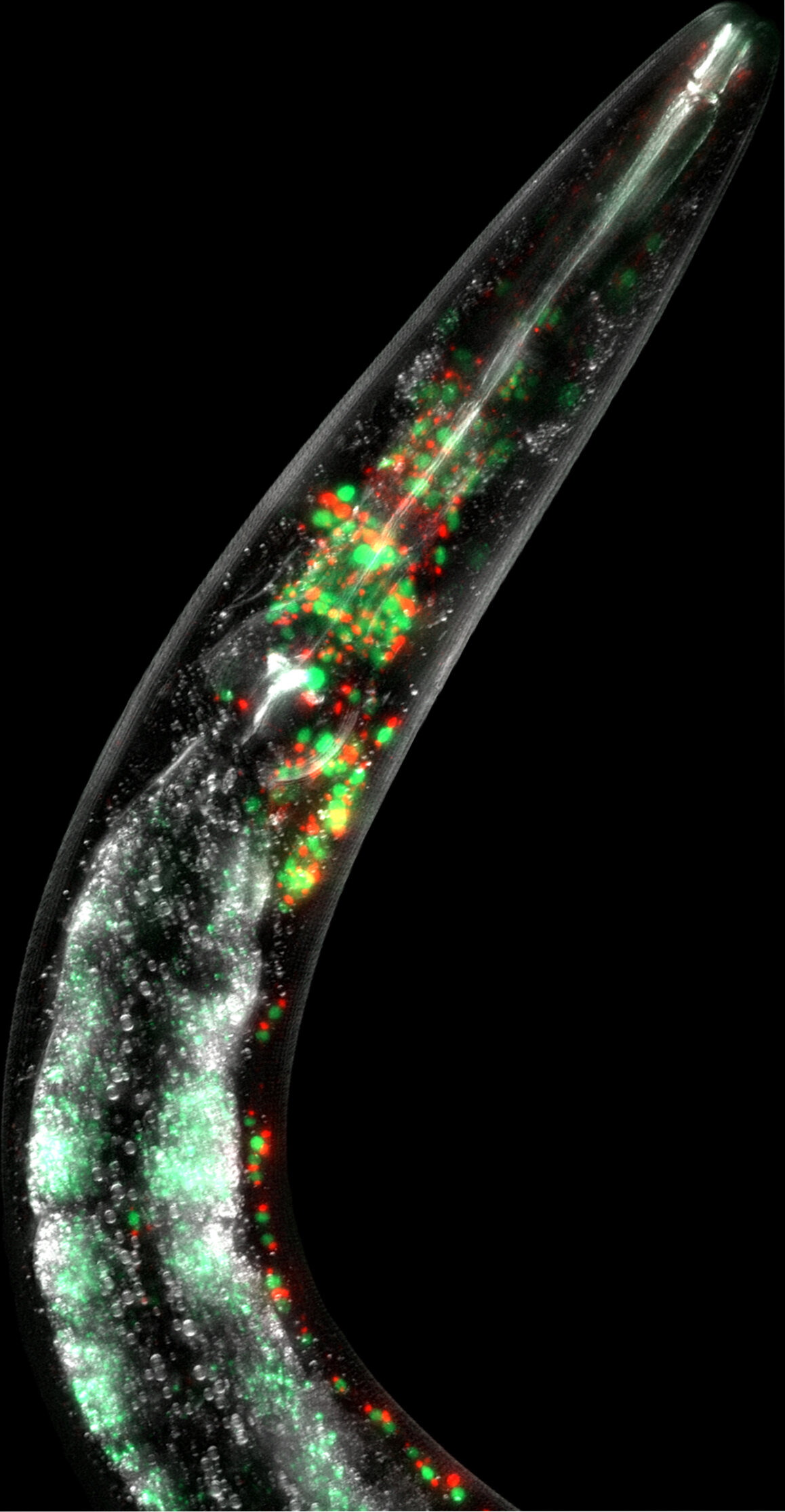 Epigenetic Solutions for Mitochondrial DNA Mutations