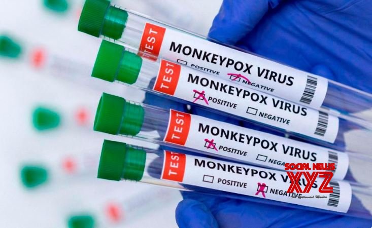 Philippines Monkeypox Case: Tips for Prevention and Recovery