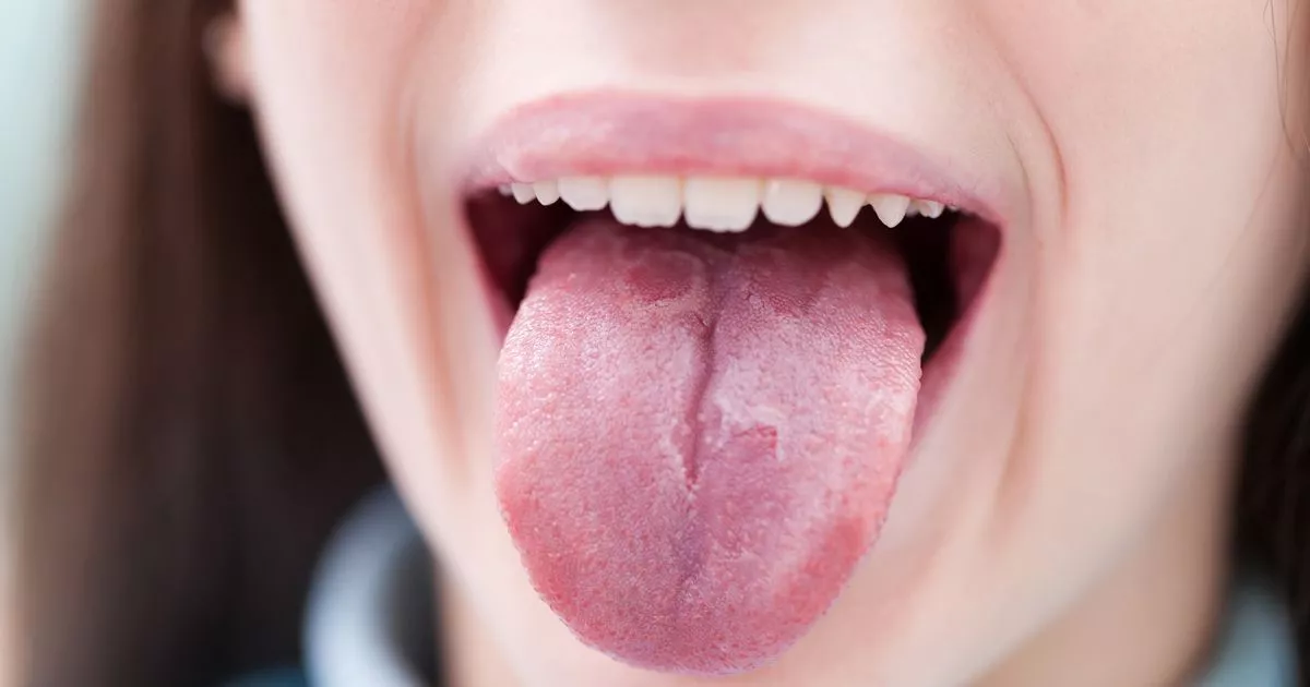 Healthy Solutions for COVID Tongue Symptoms