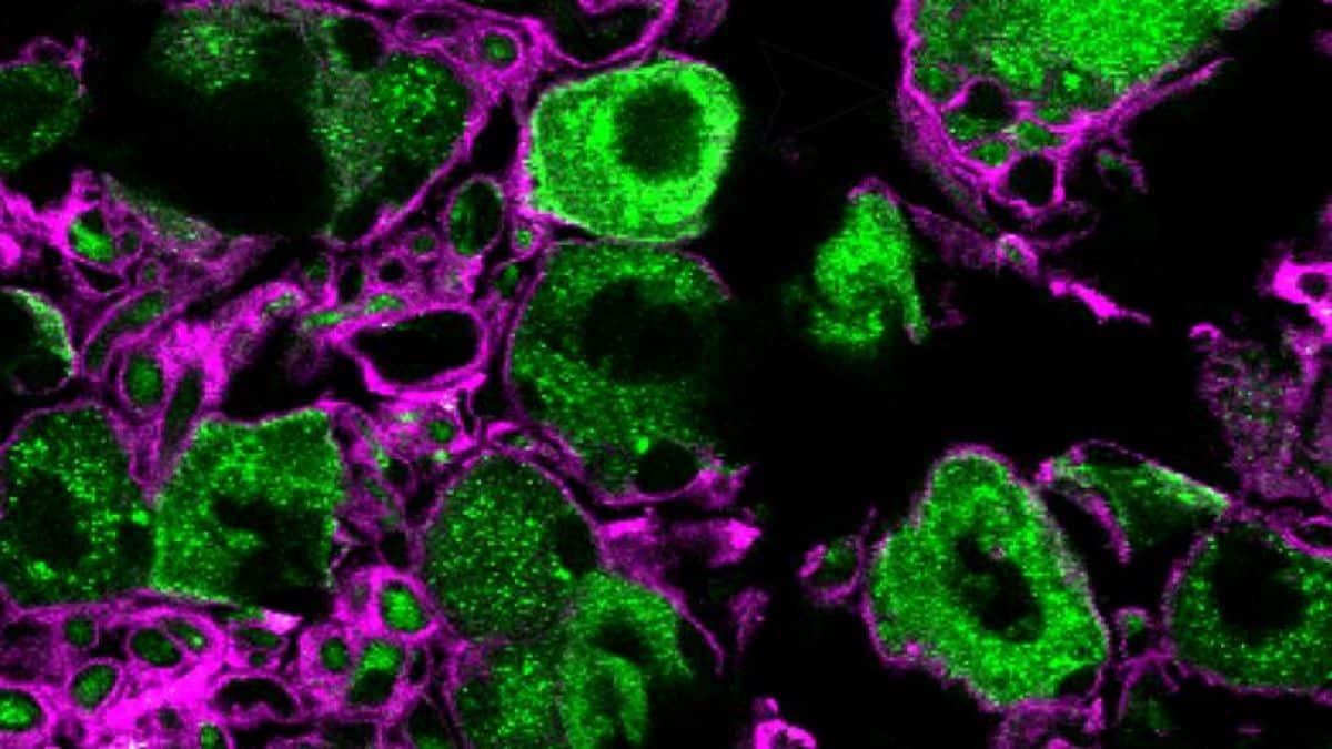 Pain Management Tips: Unlocking the Role of Neuropilin-1 in Pain Signaling