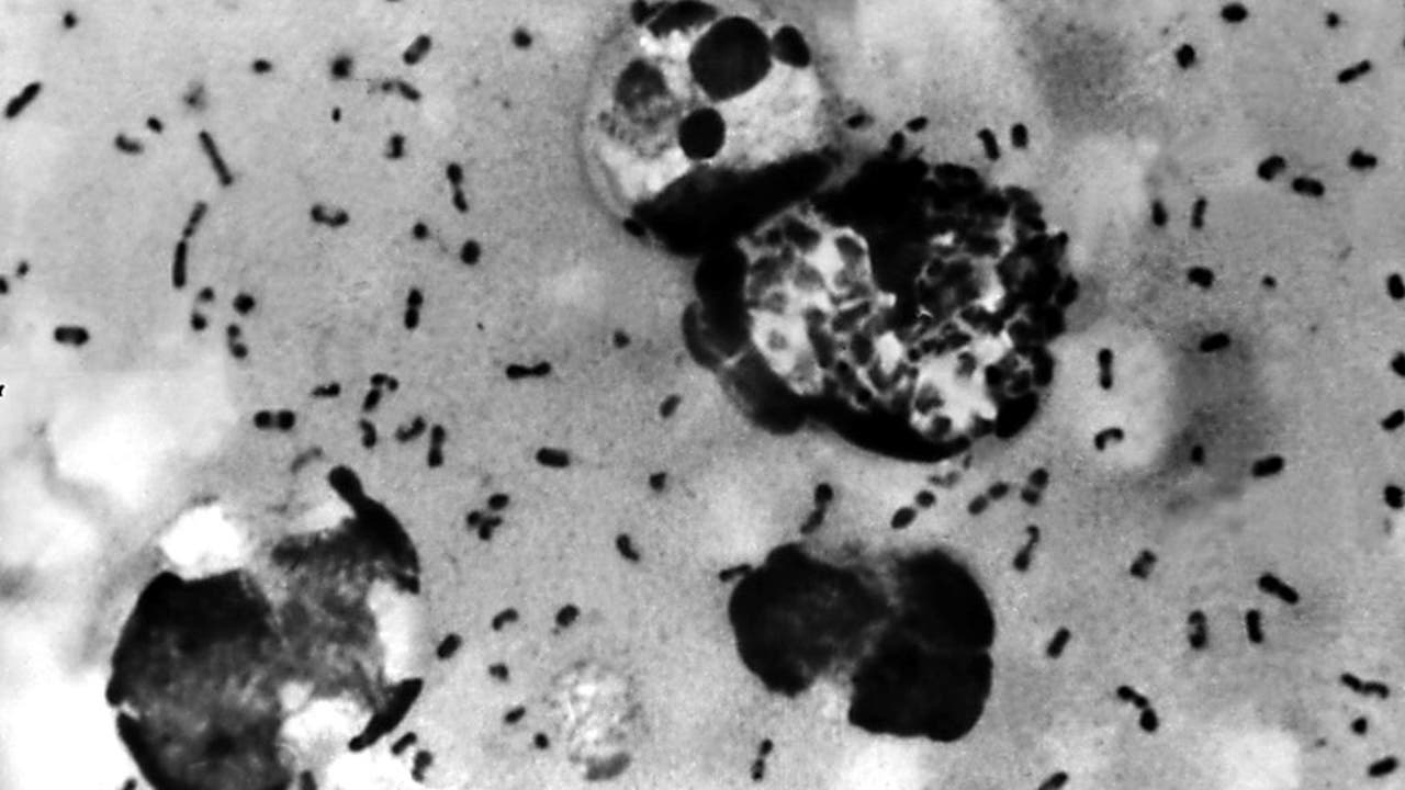 Protect Yourself: Tips to Prevent Bubonic Plague in Colorado