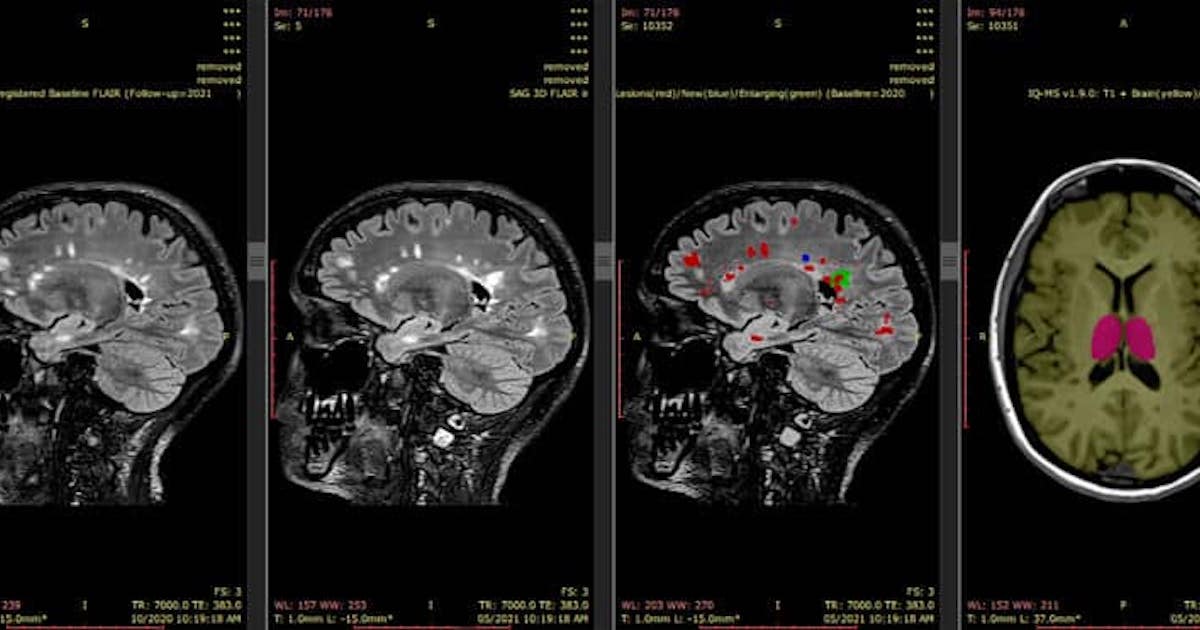 Revolutionize Medical Imaging with AI Solutions: Advancements in Health Care