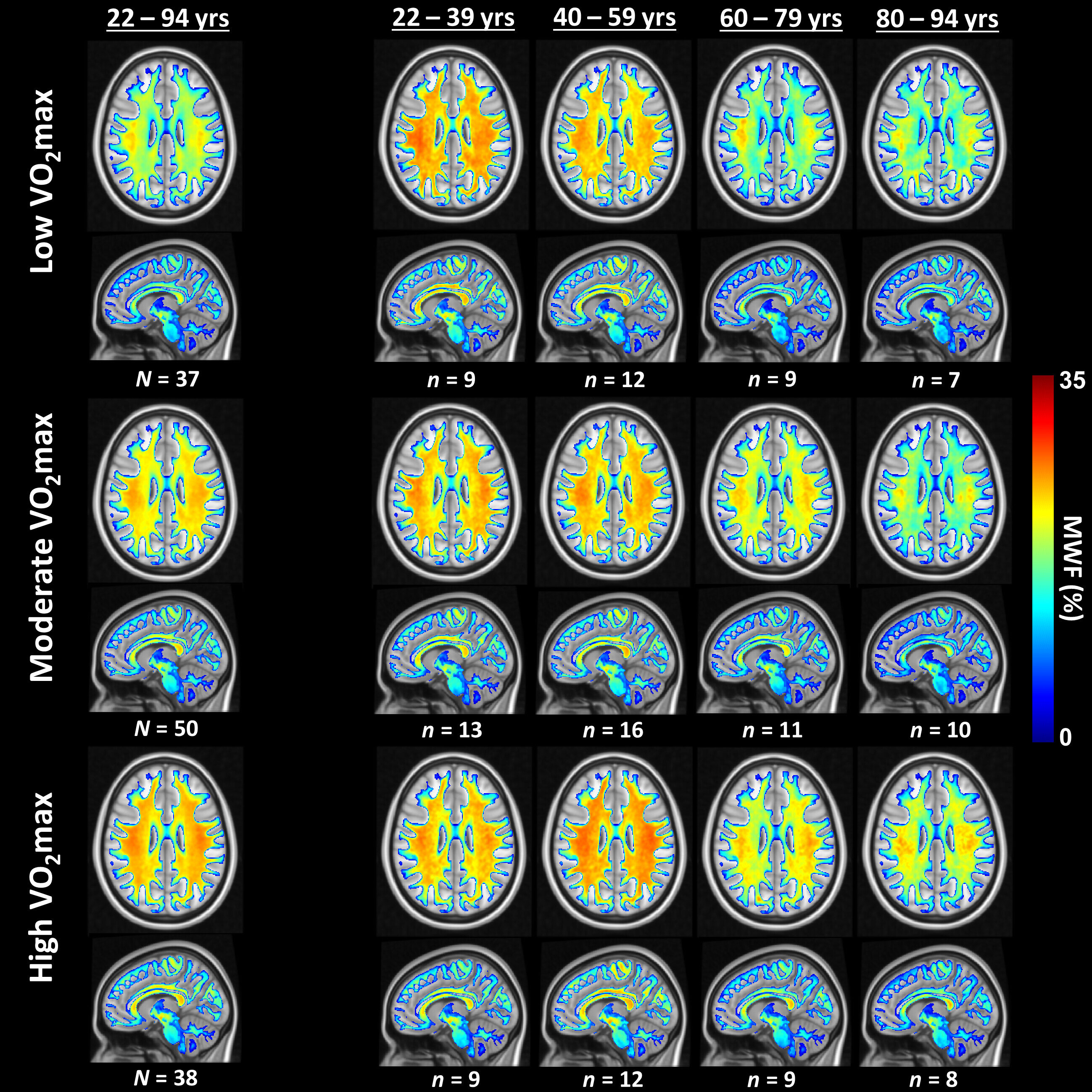 Cycling: The Solution to Boost Brain Health and Wellness