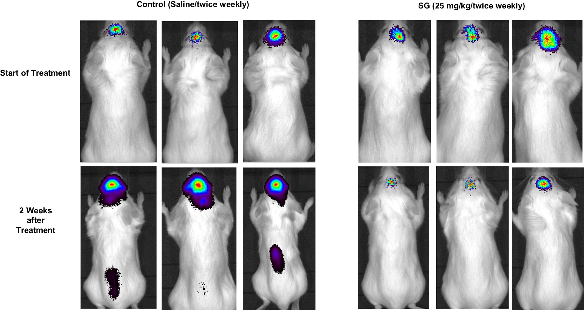 Breast Cancer Treatment Tips with Sacituzumab Govitecan