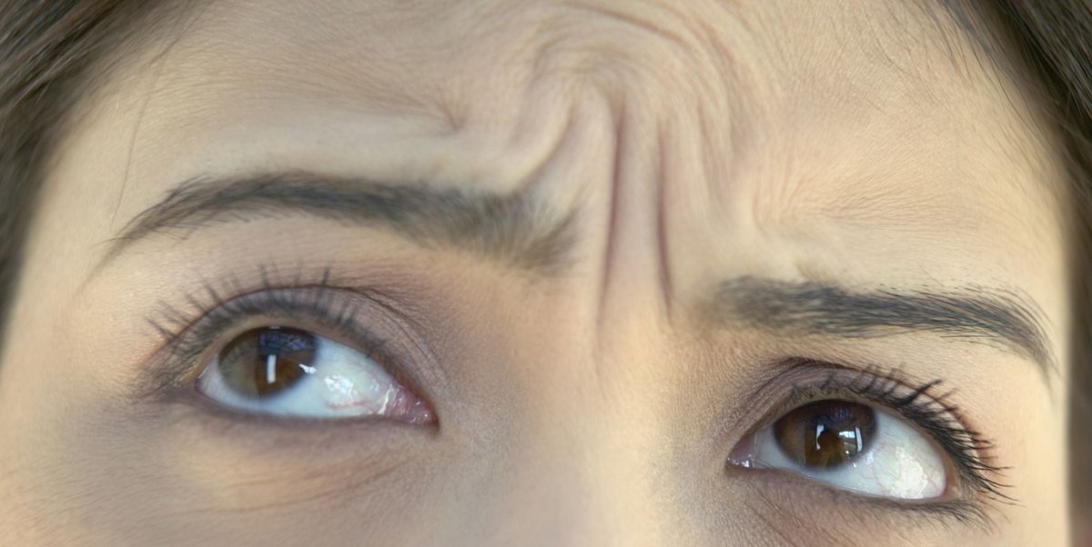 Preventing and Treating Frown Lines and Forehead Wrinkles