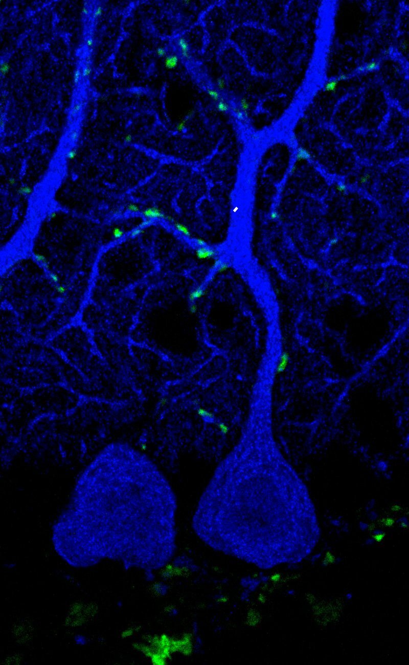 Discover the Solution: Neuroscience Research on Synaptic Plasticity in the Cerebellum