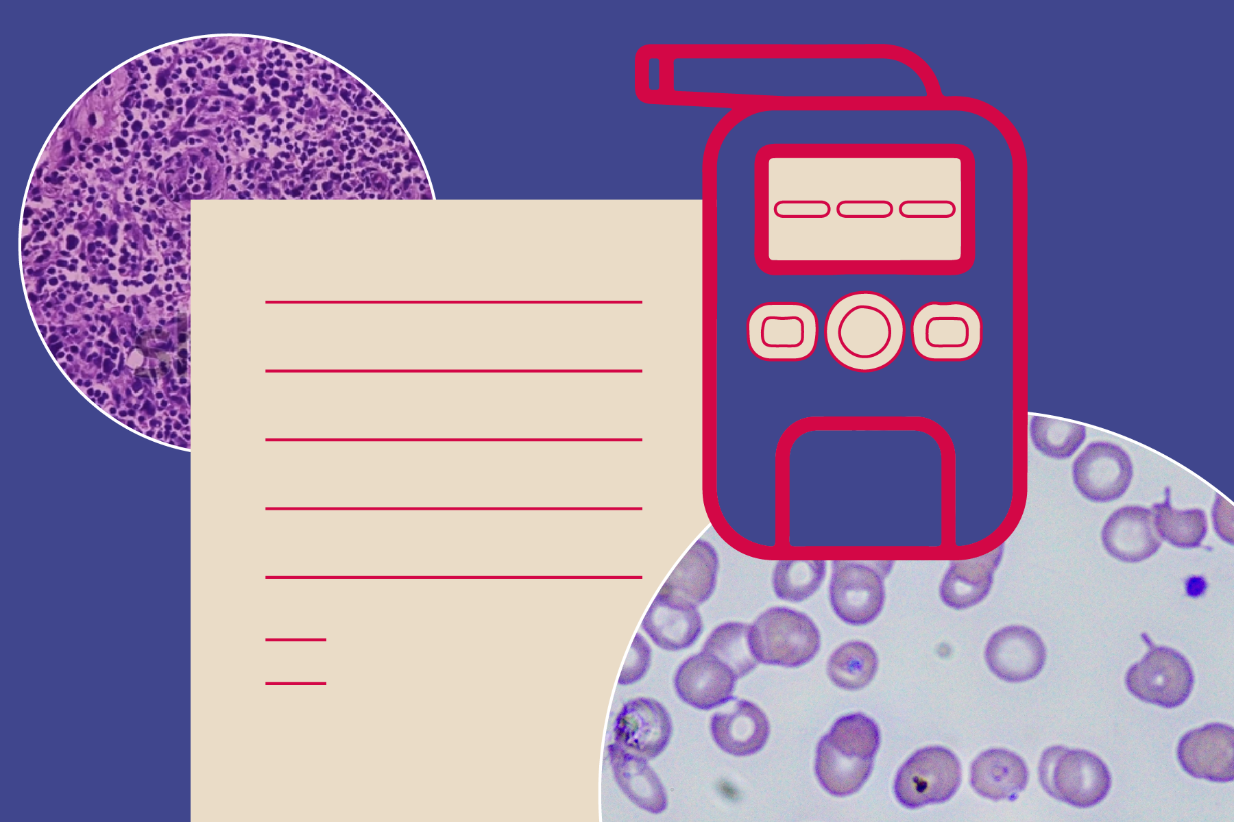 Tips for Healthy Breathalyzers: Gates Foundation Collaboration