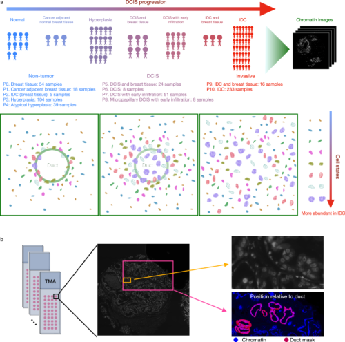 Breast Cancer Solution: Discover the Cell States and Spatial Organization Tips