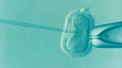 Unlock the Wellness of Assisted Reproductive Technology in Europe