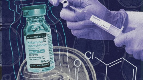 Unlock the Healing Power of Ketamine for Mental Wellness