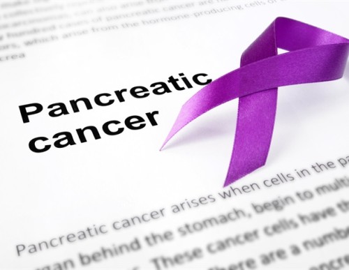 Artificial Intelligence Tips for Pancreatic Cancer Molecular Subtypes