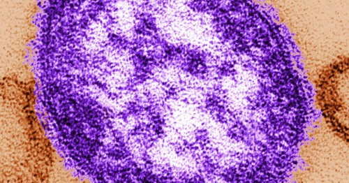 Measles Outbreak Solutions: Tips to Protect Public Health