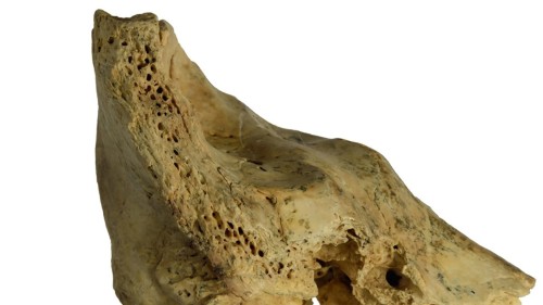 Compassionate Neanderthal Care: Insights from Down Syndrome Fossil