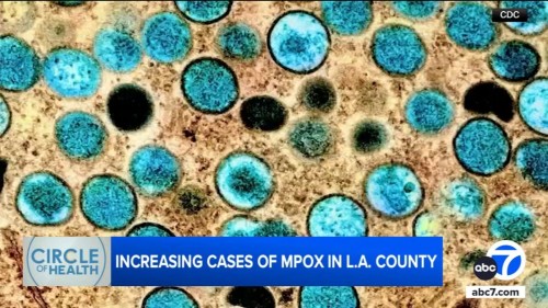 Rising Mpox Cases in Los Angeles: Vaccination Recommendations