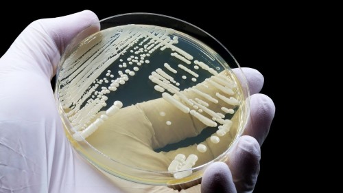 Discover Healthy Solutions to Combat Resistant Fungal Pathogen