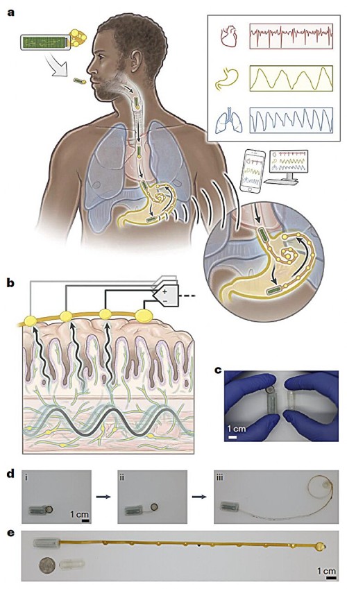 AI Monitoring of GI Tract Health with Wearable Digital Pill