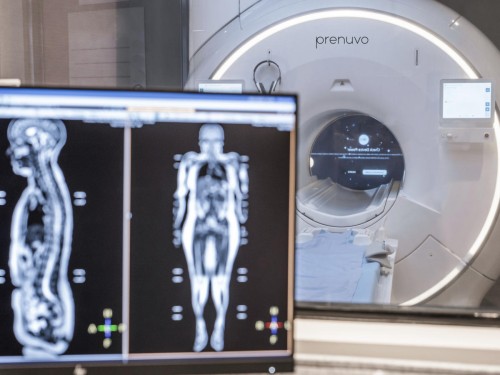 Unlock the Potential Benefits of Preventive MRI Scans with Prenuvo