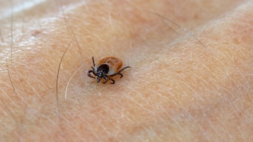 Powassan Virus Prevention Tips: Reduce Tick-Borne Disease Risk