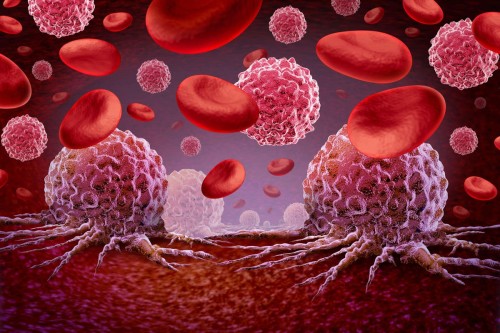 Leukemia Survival Rates: Tips for Improving Blood Cancer Awareness